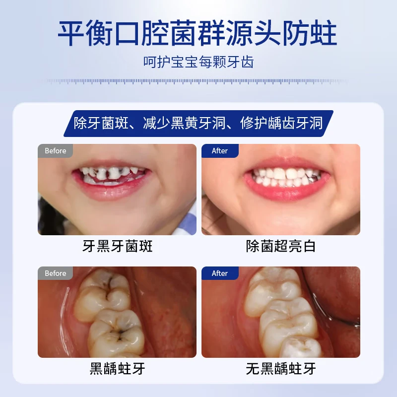 Children's toothpaste 3-12 years old containing fluoride and anti-moth children's Ora fluoride toothpaste gum care fresh breath 3 pack