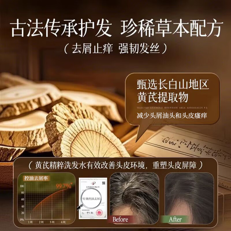 SEEDONVEUR Astragalus Herbal Shampoo and Shower Gel Set Anti-Breakage Purifying Oil Control Fluffy Anti-Dandruff Anti-Itching Fragrance Shower 2L