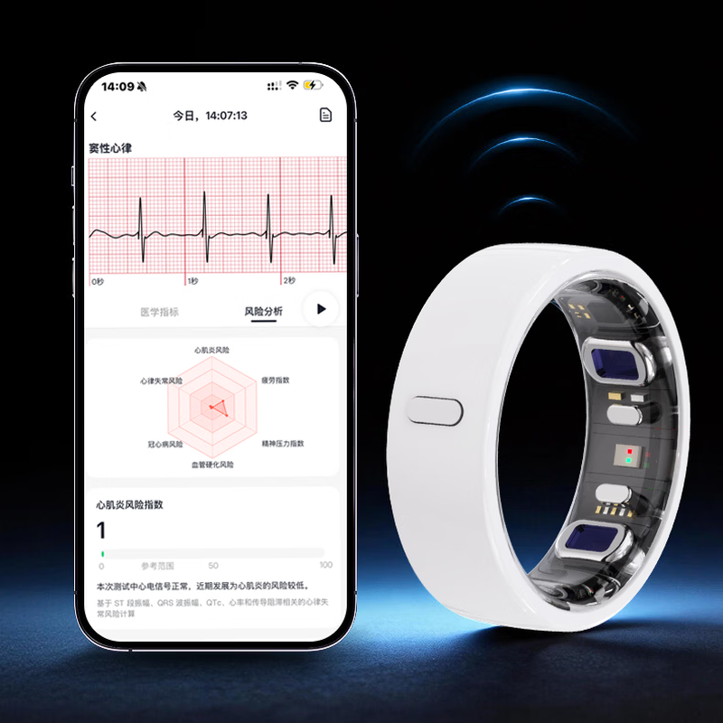 Case smart ring, ECG micro-physical examination, blood sugar, blood pressure, uric acid, blood lipids, sleep monitoring, remote care, health, heart rate, real-time value, step counting, dynamic ring, ceramic top-pink ECG, blood sugar, uric acid, blood lipids, blood pressure trend, No. 9 (diameter 19mm, finger circumference 60mm)