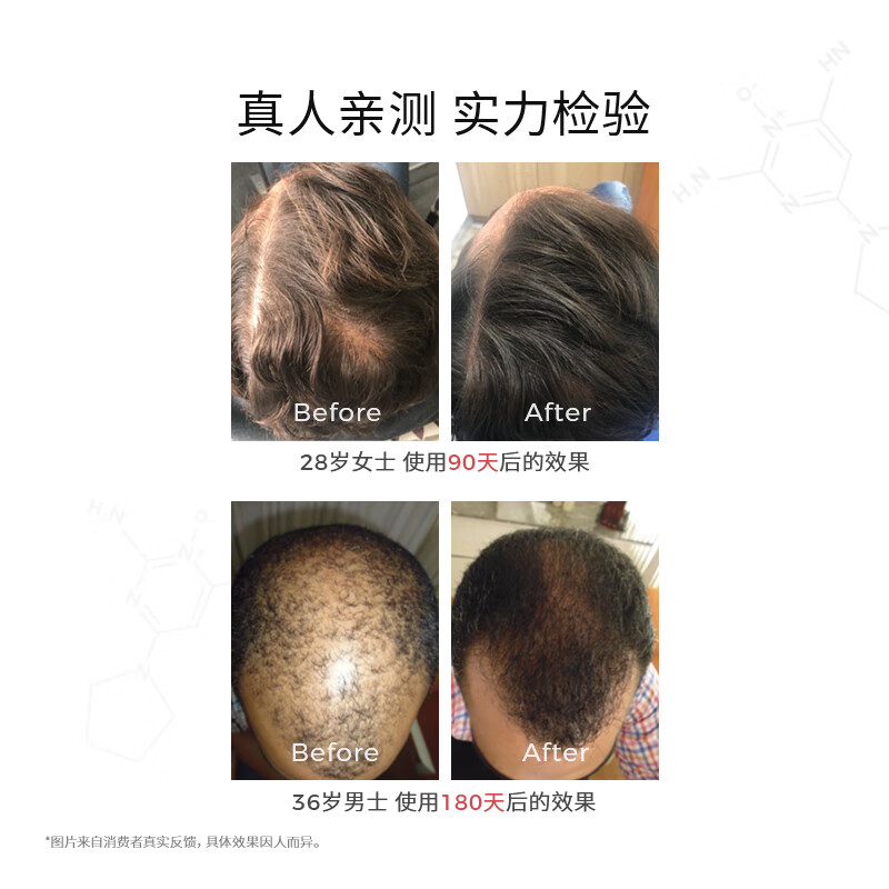 DS LaboratoriesDS laboratory Nanodil essence 60ml anti-hair loss, hair thickening and thickening, imported from the United States as a New Year gift