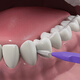 Detek imported interdental brush 32*3 Interdental brushes Brushes Brushes Brushes Brushes Brushes Brushes Brushes Brushes Brushes Brushes Brushes Brushes Brushes Brushes Brushes Brushes Brushes Brushes Brushes Brushes Brushes Brushes Brushes Brushes Brushes Brushes Brushes Brushes Brushes Brushes Brushes Brushes Brushes Brushes Brushes Brushes B