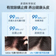 LOSOKI Suisse Suisse Follicule Hair Clean Thampooing Fat Donglai Contrôle de l'huile Contrôle de l'huile Inflammation anti-acné anti-phase pour hommes et femmes [Contrôle d'huile et démangeaisons] shampooing follicule pileux 300 ml
