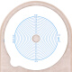 
HDL-HENDRY Hendry One-piece Exhaustable Artificial Pocket Pocket Stool Bag Medical Rectal Cancer Fistula Bag Artificial Anal Bag 1105 Large Chassis Clip Style (15-85mm)