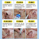 Weilong Erfuling Cat Ear Mite Medicine Ear Drops Dog Cat Ear Mite Inflammation Pet Dog Otitis Media Fungus Erfuling + Ear Bleaching 60ml Two-pronged Approach