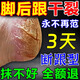 Hong Kong Pharmacy Cracked Heels Cream, Fungal Infection, Cracked and Peeling Feet, Anti-cracking, Moisturizing and Moisturizing Foot Cream w1, buy two and get one free, guaranteed to heal and prevent hair loss.