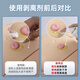 Enfermera compañera de clase Ostomy Pocket Chassis Adhesivo Spray Spray Medical Viscose Remover Stoma Care Products Remover Viscose [50 ml/botella] Remover adhesivo de chasis 12010