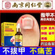 Nanjing Tongrentang specializes in treating paronychia, special treatment for ingrown toenails, redness, swelling and pain, granulation and polyp removal, swelling and suppuration, deep foot care 1 box Tongrentang