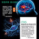 Dispositivo de terapia de estimulación magnética transcraneal para accidente cerebrovascular infarto de accidente