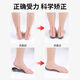 O-shaped leg flat foot correction foot valgus, calf valgus correction leg shape artifact straight leg foot half palm invisible tool M code 35-39 white 1 pair