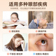 Zhiding Huiming Dryy Eye Atomizer Eye Steam Hot Compress Eye Protection Eye Protection Dry Eye Hydratant Instrument de machine à fumigation Spray [Grande Cavité Masque pour les yeux] Fense chaude - Convient pour éliminer le blocage des glands Meibomian
