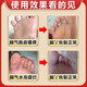 Yunnan Materia Medica special 100% special spray for sweaty feet and stinky feet to prevent and remove stinky feet, sore feet, sweaty feet, athlete's foot artifact antibacterial spray, medicated spray, buy 2 get 1 free, long-term foot odor and foot sweat