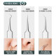 Xidomi ultra-sharp acne needle cell clip blackhead needle acne tool acne beauty removal acne squeezing tweezers 7-piece set