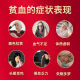 力玖硫酸亚铁片 铁剂补铁补血改善贫血孕妇儿童适用缺铁性贫血补血药贫血药补铁成人 营养不良补血营养品 1盒