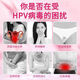 修正抗hpv生物蛋白敷料凝胶转阴阴道炎凝胶药妇科私处杀菌消炎宫颈炎 5盒装1个疗程 立减16778女性选