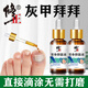 Correct onychomycosis antibacterial liquid, non-special effect, deck thickening and discoloration, nail groove fungal infection, impatiens sterilization and nail removal, 2 bottles of onychomycosis antibacterial liquid, moderate, no problem