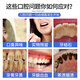 DR.SOKK洁牙粉美白去黄洗牙粉口臭黄去牙渍去烟渍牙结石牙齿清洁器除牙垢