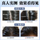 南京同仁堂二硫化硒洗发水去屑止痒滋养头皮控油蓬松毛囊清洁头屑止痒男女士 二硫化硒洗发水1瓶300ml