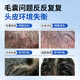 LEASCAN二硫化硒洗发水去屑止痒洗剂控油蓬松男女士专用毛囊清洁洗发液露