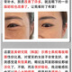 示博士【香港大药房】蛇毒肽去眼袋眼霜黑眼圈脂肪粒去细纹紧致抗皱保湿 3瓶【中度眼袋适用】
