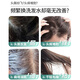 舒蕾氧活O2 Dynamic止痒去屑双专利洗发水 400g 清凉 老牌国货
