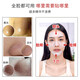 Ruwei (RNW) blackhead removal nose mask 5 sets of 10 pieces tear-free ramen mask export essence acne shrinkage