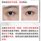 示博士【香港大药房】蛇毒肽去眼袋眼霜黑眼圈脂肪粒去细纹紧致抗皱保湿 3瓶【中度眼袋适用】