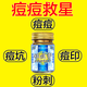 Hong Kong Pharmacy Hong Kong Dafang Hong Kong Dafang Acne Paste Acne Pit Repair and Fade Acne Scars Acne Scars HXM9737 [Fragrant [Hong Kong Acne Paste] 2 boxes - Standard acne pack