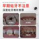 Colongon英国进口宝宝儿童牙膏3-6-12岁专效防蛀固齿含氟牙膏牙龈护理50g