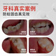 Colongon英国进口宝宝儿童牙膏3-6-12岁专效防蛀固齿含氟牙膏牙龈护理50g