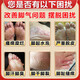 Yunnan Materia Medica special 100% special spray for sweaty feet and stinky feet to prevent and remove stinky feet, sore feet, sweaty feet, athlete's foot artifact antibacterial spray, medicated spray, buy 2 get 1 free, long-term foot odor and foot sweat