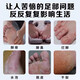Yunnan Materia Medica Genuine Foot Antibacterial Spray Foot Antibacterial Cream Sweat Foot Odor Water Air Spray SN9911 999 Fluid/Effect [Minority/Athlete]