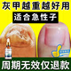 Lejia old store Nanjing Tongrentang special plaster for treating severe onychomycosis, nail fungus infection onychomycosis antibacterial liquid