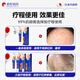 
Songcheng Pharmaceutical Folliculitis Pussy Loss Scalp Bacteria Folliculitis Folliculitis Folliculitis Fungal Infection