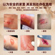 Yunzutang burn ointment for blistering, red and swollen wounds