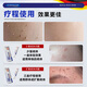 
ELSIEDOCTOR Pharmaceutical Wart Removal Cream Flat Warts Special Plantar Warts Acupuncture Warts Silk Warts Warts Spirit Neck Small Meat Neck