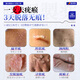 
Fujita Pharmaceutical Wart Removal Body Loss Flat Warts Special Stream Warts Genital Warts Plantar Warts Wart Removal Neck Neck 1 Box