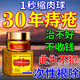 Chicao Benhara Japan imported hemorrhoid cream to eradicate genuine i-meat ball artifact internal hemorrhoids and external hemorrhoids special plaster medical gel 100% special effect severe mole hemorrhoids a box of hemorrhoid cream to quickly reduce swelling, stop bleeding, relieve pain and treat hemorrhoids