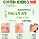 Guangdao's acne patch anti-inflammatory and pus-absorbing medical repair acne marks, remove acne and lighten acne and acne special teenagers 1 box