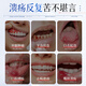 
Honda Pharmaceutical Oral Ulcer Spray Oral Ulcer Inflammation on Fire Foaming Oral Aphrodisiac Antibacterial Anti-inflammatory Pain Relieving Swelling 1 box