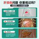 云南白药护肝片养之素舒甘片舒肝养肝保肝应酬加班熬夜降转氨酶 1瓶体验装【贵在运费】