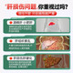 仁和护肝胶囊护肝片新态牌玉米葛根枳椇子胶囊*5养肝护肝排毒烟酒常备