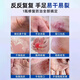 Baiyunshanwei E urea cracked rod foot crack cream heel dry crack crack anti-crack cream to improve rough hand and foot hand cream 30g