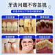 Nanjing Tongrentang whitening toothpaste removes bad breath, removes yellow tooth stains, removes tea and tobacco stains, freshens breath, cares for gums, top ten well-known brands, three boxes, suitable for yellow teeth, tooth stains, tobacco stains