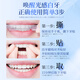 Light Island made tooth patch whitening teeth and yellowing artifact quickly whitening and gentle without sour teeth 2 boxes