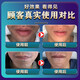 Lan Yanzhi removes black marks on beard, fades stubble, whiskers, and lips permanently. Roots no longer grow. Hair removal cream for men. Hair removal cream. Buy three, get two free. Refuse to repeat.