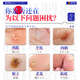 Fujita Pharmaceutical Japanese Corn Patch to remove painless fleshy thorns and remove plantar warts and sole toe warts by the roots 1 box
