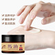Qingzitang horse oil anti-cracking cream for cracked hands and feet horse oil cream for cracked feet and heels moisturizing moisturizing cream 35g