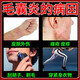 Folliculitis head medicine Folliculitis ointment Itchy scalp with pimples and redness Pimples and pustules on the head Scalp hair follicle medicine Inflammation special new validity period medicine Erythromycin ointment 3 boxes No itching anymore Highly recommended by patients Jingdong Pharmacy Official flagship store authentic Jingdong Pharmacy