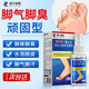 Fujiku Pharmaceutical Athlete's Foot Spray Anti-itching Peeling Rotten Feet Fungal Infection Foot Odor Spray Feet Sweating Foam Deodorizing Itching 60ml