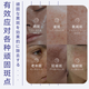 Naxi Japan 377 Niacinamide Whitening Cream Lightening Melanin Removal of Freckles, Melasma Sunscreen Cream Men and Women
